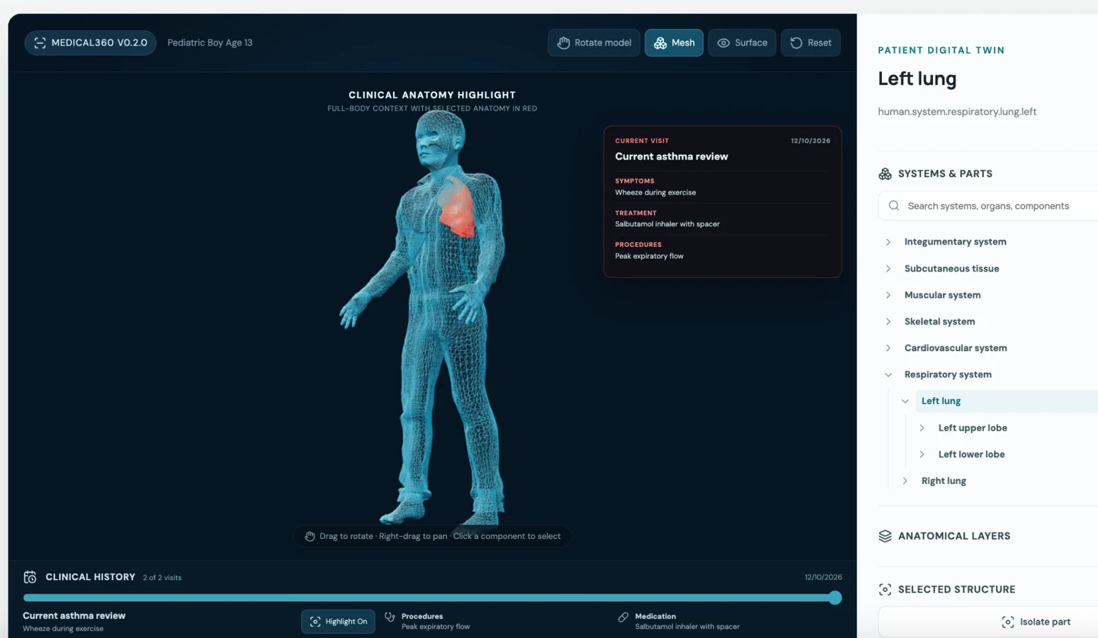 Medical360 patient anatomy digital twin with selected left lung and visit context
